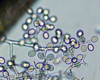 Figure 4. Magnified view of spores (sporangia: sac-like structures filled with swimming spores). Photo: Michigan State University.