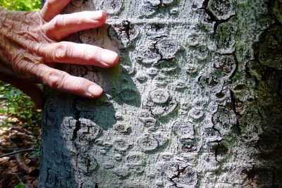 Rough, cracked beech bark covered in circular, raised scale infestations with a hand resting on the trunk for size reference.